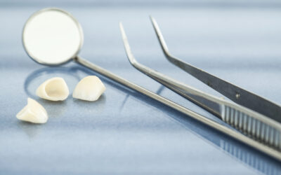 EREC Dental Crowns: The Rising Trend in Dental Tourism