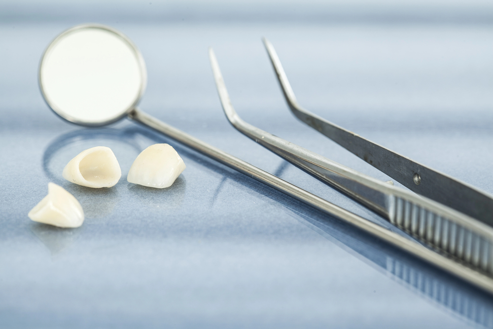 EREC Dental Crowns: The Rising Trend in Dental Tourism
